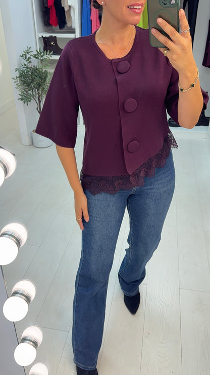 Farren Button Front Asymmetric Lace Hem Top